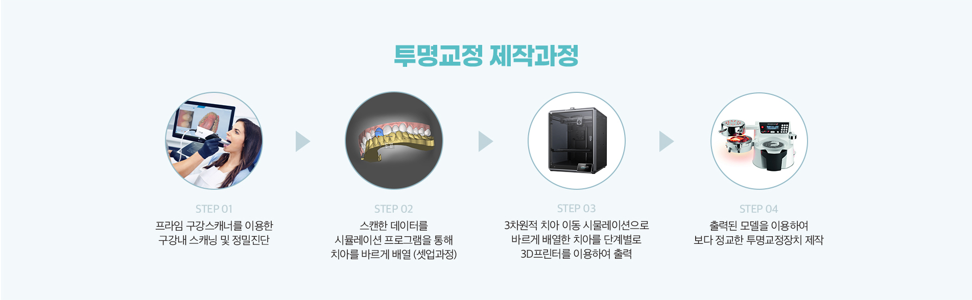 투명교정 제작과정